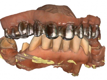 Dentallabor Feldmann - Digitale Daten 1