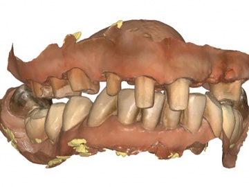 Dentallabor Feldmann - Digitale Daten 3