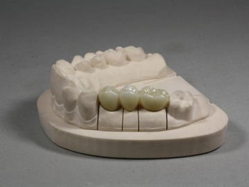 Dentallabor Feldmann - gefräste Modelle - Bild 1