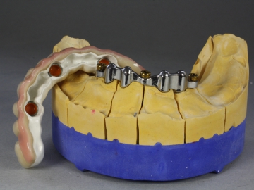 Dentallabor Feldmann - gefräste Stege - Bild 4