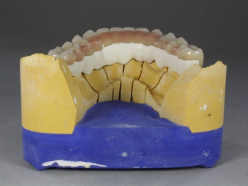 Dentallabor Feldmann - gefräste Stege - Bild 6