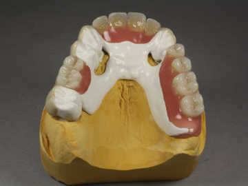 Dentallabor Feldmann - Zahnersatz für Allergiker - Bild 24