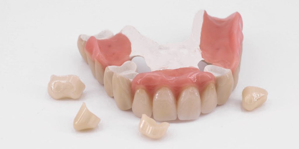 Total Prothesis Totalprothese – Dentallabor Feldmann